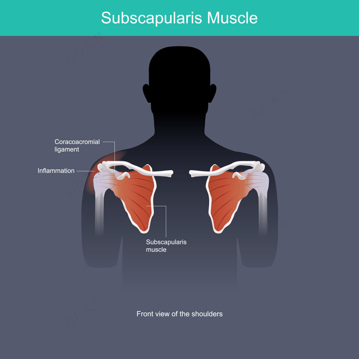 骨骼肩胛下肌肉炎症肩膀的肌肉在前视图中肌肉解剖学解剖学