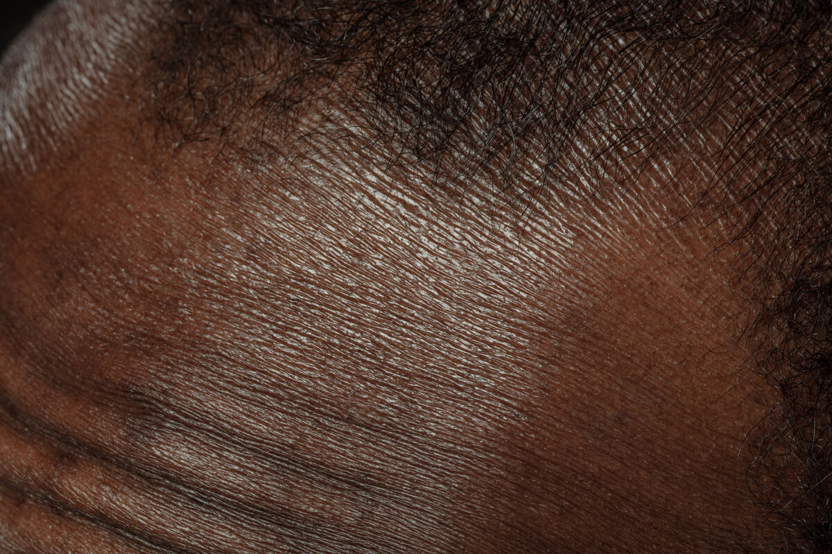 封闭头部 面部人体皮肤的详细纹理非洲裔美国年轻男性身体的特写镜头护肤 身体护理 保健 卫生和医学概念看起来美丽 保养良好皮肤科健康温暖医学