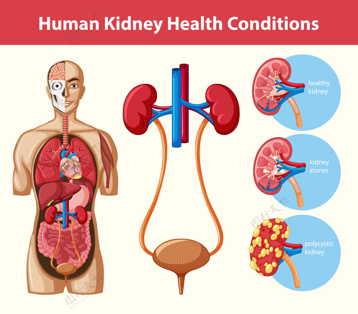 解剖学人类肾脏健康状况信息图状况健康卡通