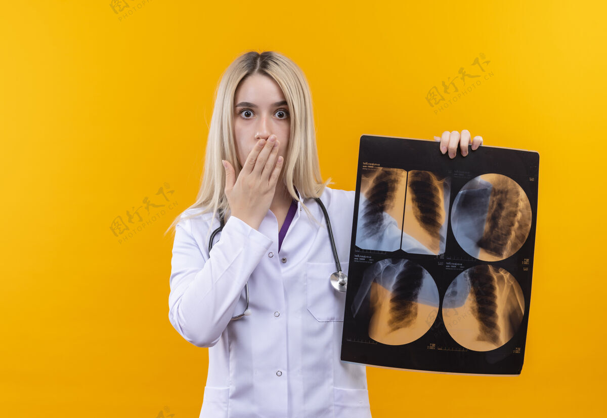 手惊讶的医生穿着医用长袍戴着听诊器的年轻女孩拿着x光片 手捂着嘴 背景是孤立的黄色女孩罩子医学